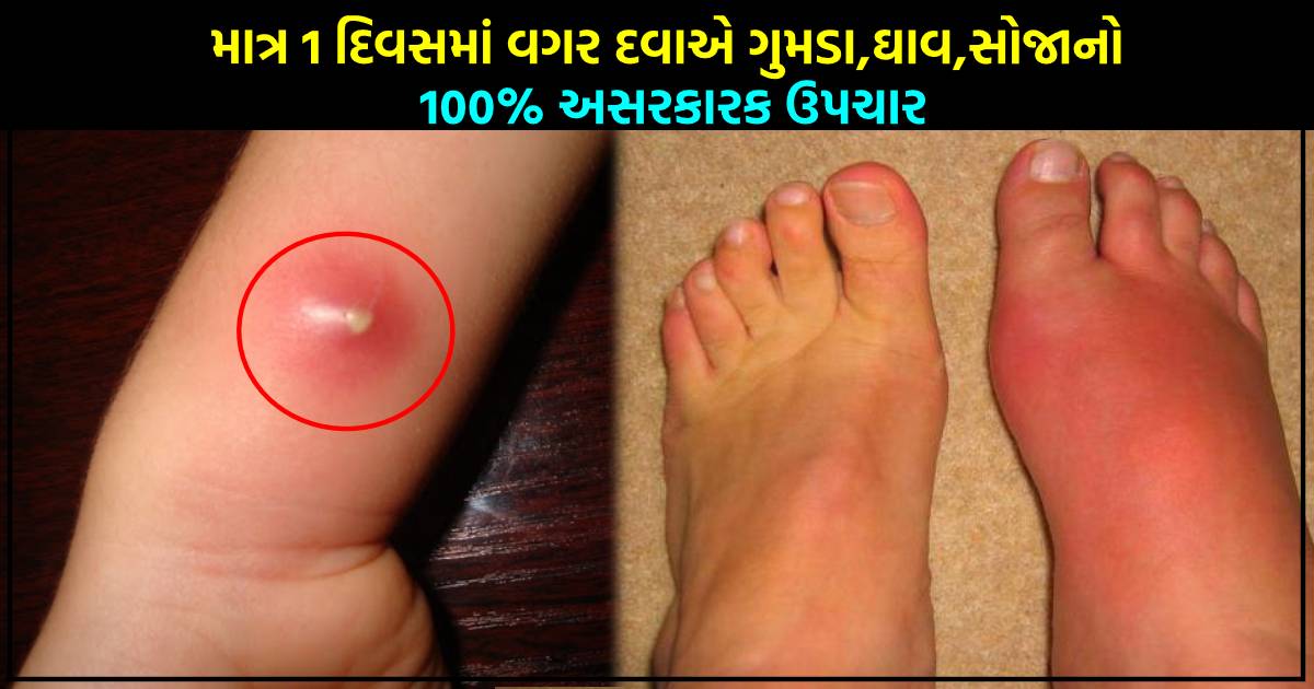 માત્ર 1 દિવસમાં વગર દવાએ ગુમડા, ઘાવ, સોજા માથી મળી જશે છુટકારો, જીવનભર એ જગ્યાપર નહીં થાય ગુમડા
